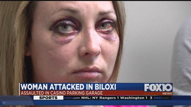 Woman beaten bloody in a casino parking lot in Biloxi